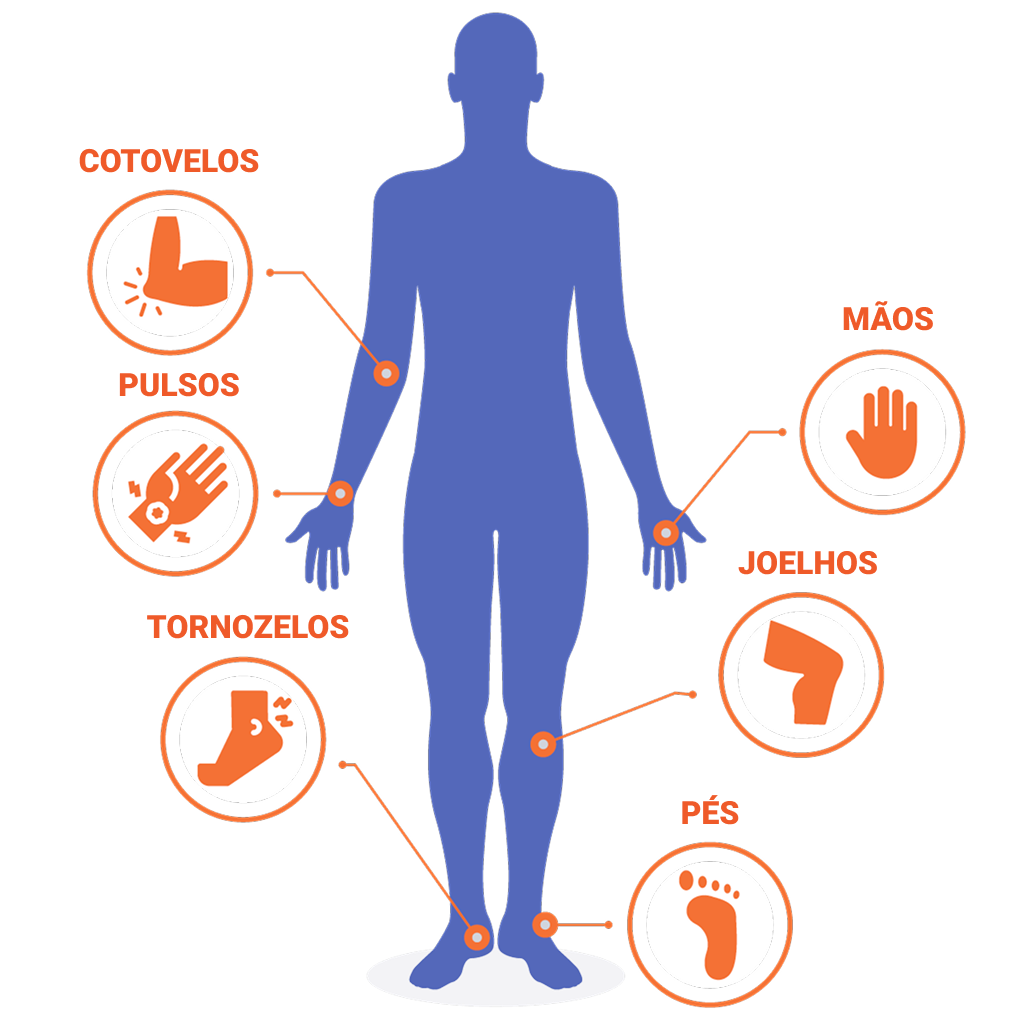 artrite-reumatoide-02